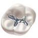 This is an example of an amalgam.
