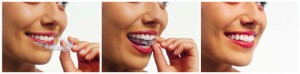 Invisalign is offered at Dental Health Colorado